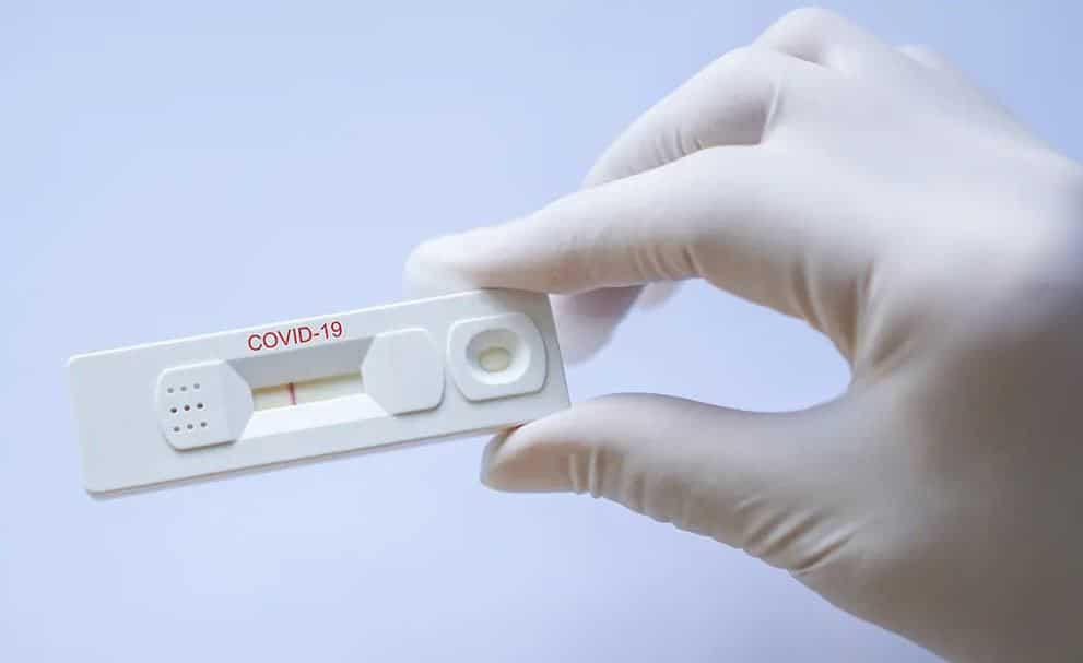 test coronavirus pharmacie
