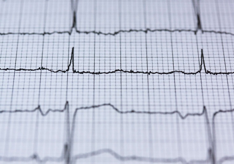 troubles cardiovasculaires